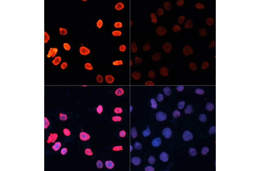 Immunofluorescence - Anti-Histone H3 (acetyl Lys18) Antibody (A16743) - Antibodies.com