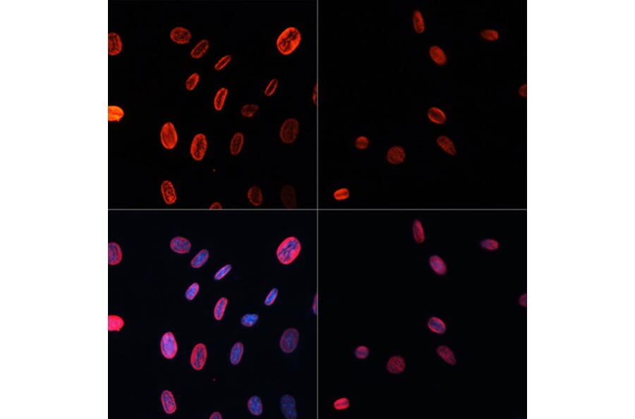 Immunofluorescence - Anti-Histone H3 (acetyl Lys18) Antibody (A16743) - Antibodies.com