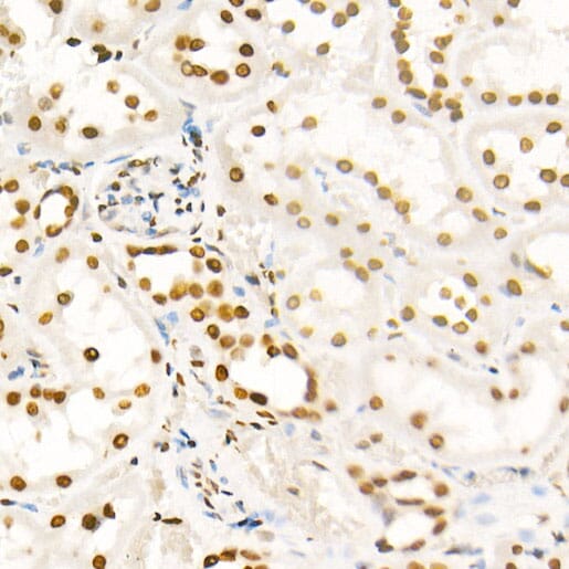 Immunohistochemistry of paraffin-embedded rat ovary using Anti-Histone H4 (acetyl K8) Antibody (A7258) at dilution of 1:100 (40x lens).