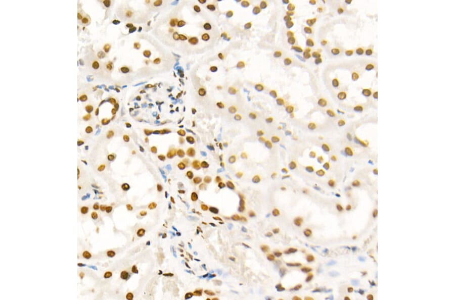 Immunohistochemistry - Anti-Histone H4 (acetyl Lys8) Antibody (A16744) - Antibodies.com