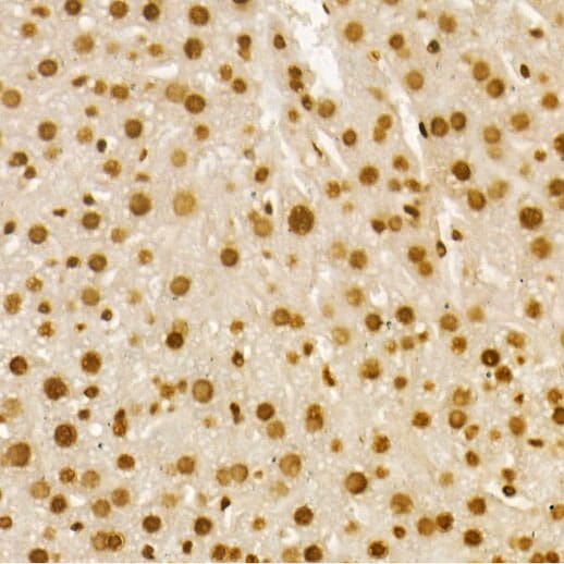 Immunohistochemistry of paraffin-embedded human breast using Anti-Histone H4 (acetyl K8) Antibody (A7258) at dilution of 1:100 (40x lens).