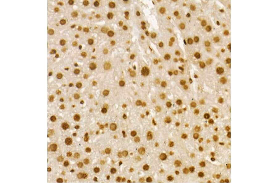 Immunohistochemistry - Anti-Histone H4 (acetyl Lys8) Antibody (A16744) - Antibodies.com
