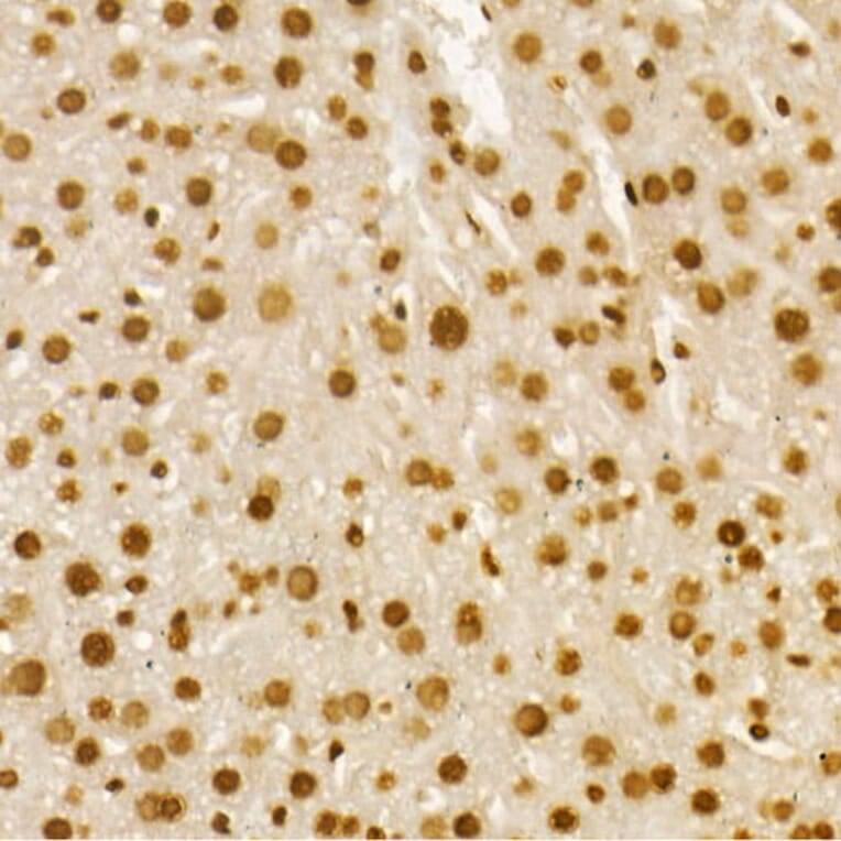 Immunohistochemistry - Anti-Histone H4 (acetyl Lys8) Antibody (A16744) - Antibodies.com