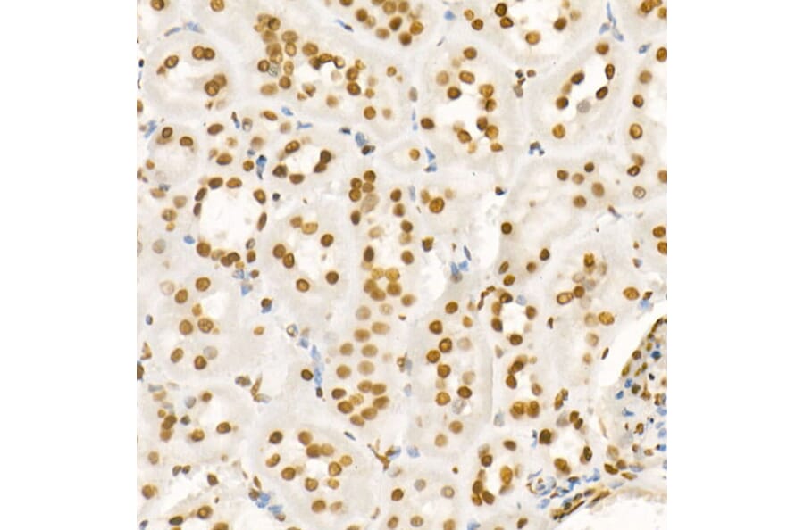 Immunohistochemistry - Anti-Histone H4 (acetyl Lys8) Antibody (A16744) - Antibodies.com