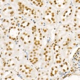 Immunohistochemistry - Anti-Histone H4 (acetyl Lys8) Antibody (A16744) - Antibodies.com