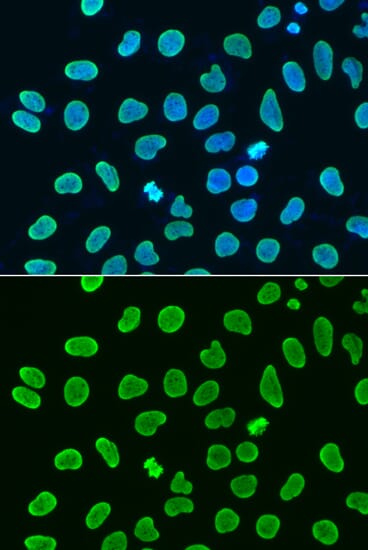 Immunofluorescence analysis of HeLa cells using Anti-Histone H4 (acetyl K8) Antibody (A7258). Blue: DAPI for nuclear staining.