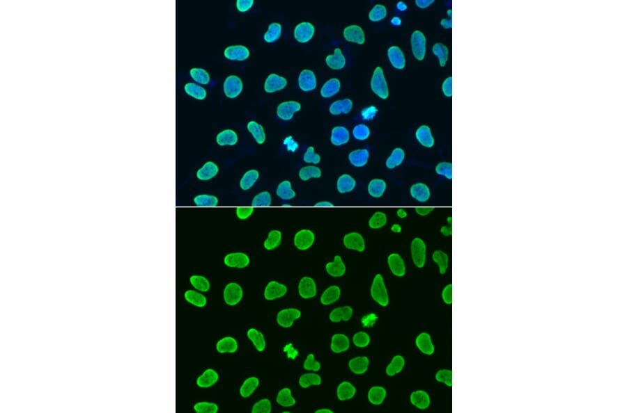 Chromatin Immunoprecipitation - Anti-Histone H4 (acetyl Lys8) Antibody (A16744) - Antibodies.com