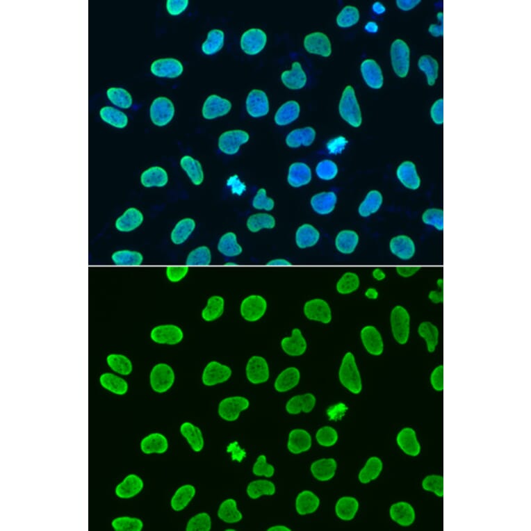 Chromatin Immunoprecipitation - Anti-Histone H4 (acetyl Lys8) Antibody (A16744) - Antibodies.com