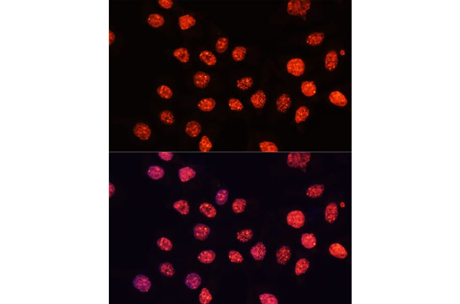 Immunofluorescence - Anti-Histone H3 (tri methyl Lys56) Antibody (A16746) - Antibodies.com