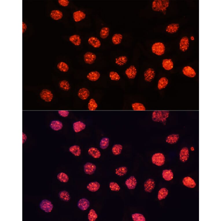 Immunofluorescence - Anti-Histone H3 (tri methyl Lys56) Antibody (A16746) - Antibodies.com