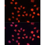 Immunofluorescence - Anti-Histone H3 (tri methyl Lys56) Antibody (A16746) - Antibodies.com