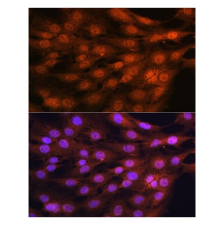 Immunofluorescence - Anti-YAP1 Antibody (A16747) - Antibodies.com