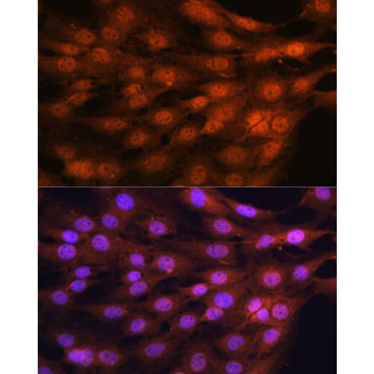 Immunofluorescence - Anti-YAP1 Antibody (A16747) - Antibodies.com