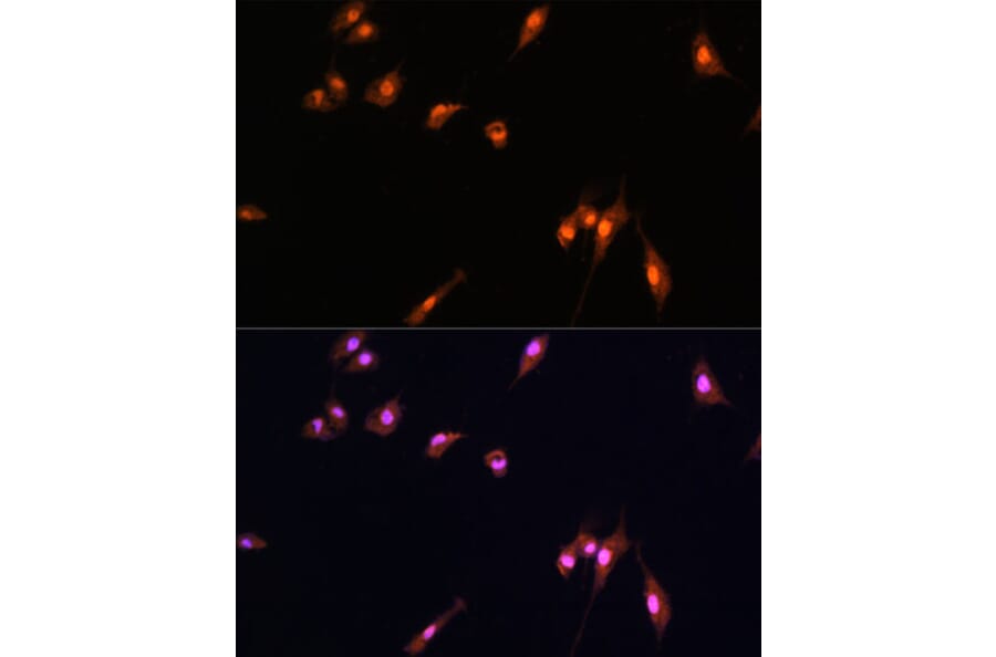 Immunofluorescence - Anti-YAP1 Antibody (A16747) - Antibodies.com