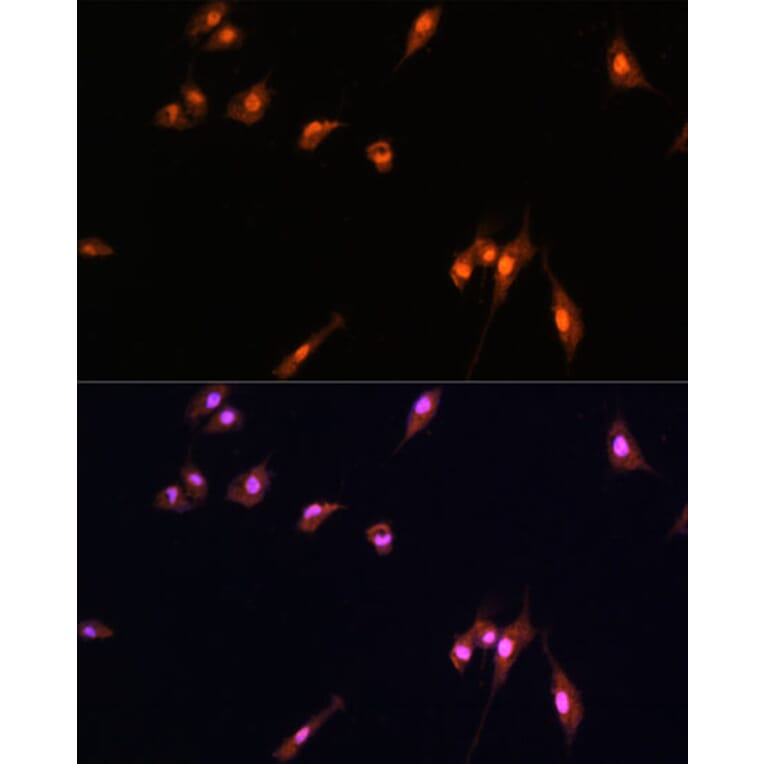 Immunofluorescence - Anti-YAP1 Antibody (A16747) - Antibodies.com