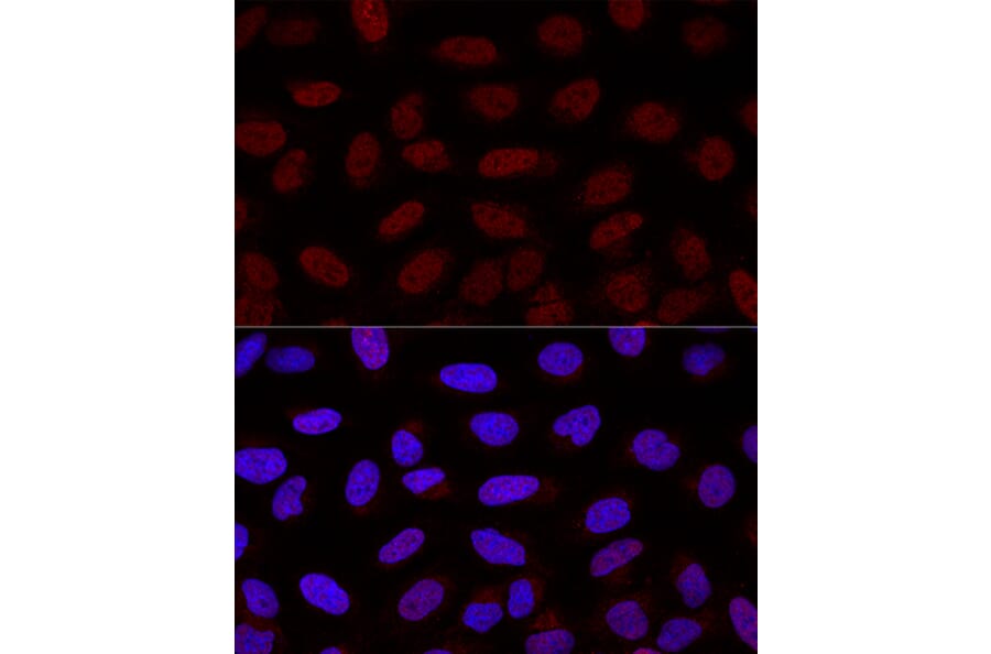 Immunofluorescence - Anti-YAP1 Antibody (A16747) - Antibodies.com