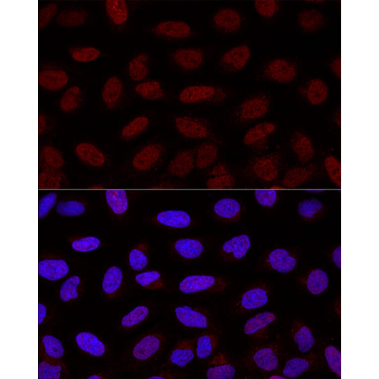 Immunofluorescence - Anti-YAP1 Antibody (A16747) - Antibodies.com