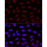 Immunofluorescence - Anti-YAP1 Antibody (A16747) - Antibodies.com