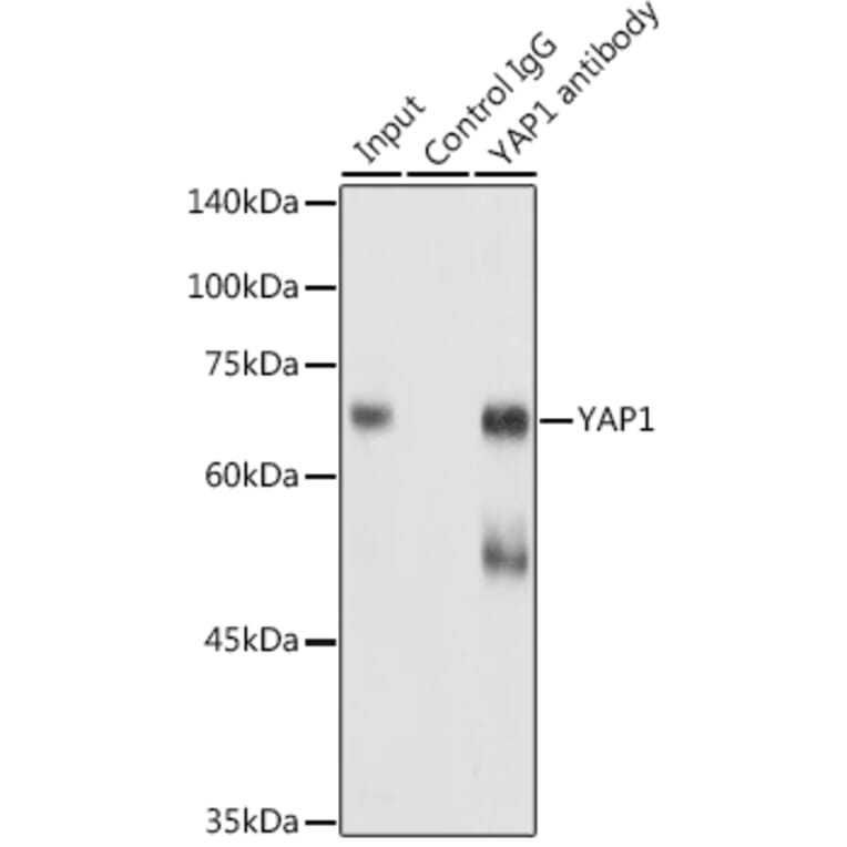 Western Blot - Anti-YAP1 Antibody (A16747) - Antibodies.com