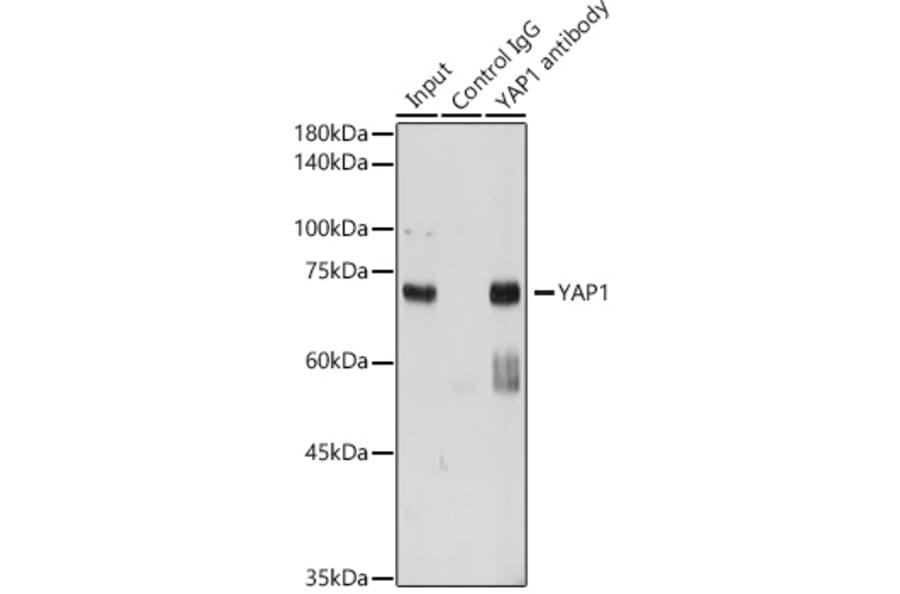 Western Blot - Anti-YAP1 Antibody (A16747) - Antibodies.com