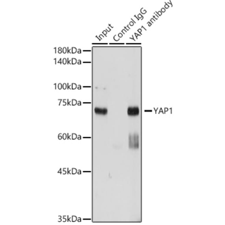 Western Blot - Anti-YAP1 Antibody (A16747) - Antibodies.com