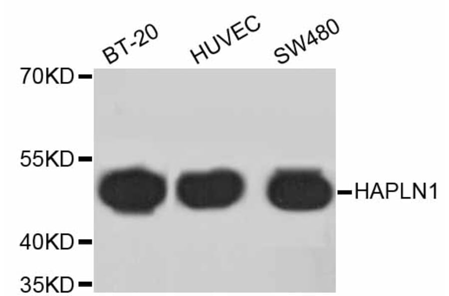Western Blot - Anti-HAPLN1 Antibody (A10828) - Antibodies.com