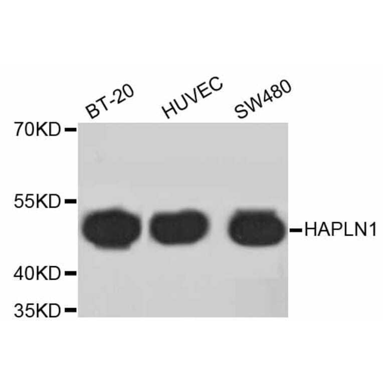 Western Blot - Anti-HAPLN1 Antibody (A10828) - Antibodies.com