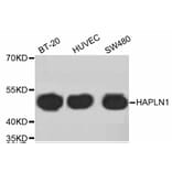 Western Blot - Anti-HAPLN1 Antibody (A10828) - Antibodies.com
