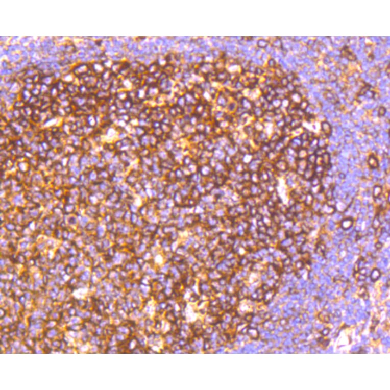 Immunohistochemistry - Anti-HAPLN1 Antibody (A10828) - Antibodies.com
