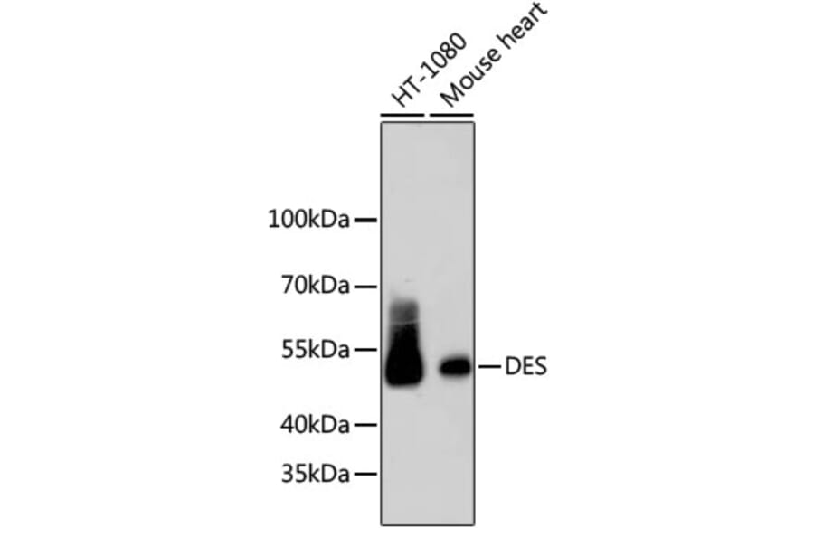 Western Blot - Anti-DES Antibody (A10837) - Antibodies.com