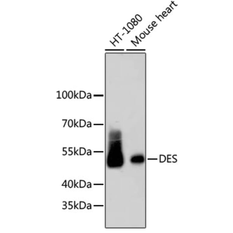 Western Blot - Anti-DES Antibody (A10837) - Antibodies.com