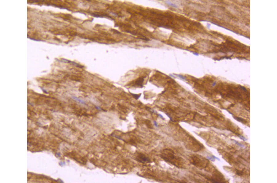 Immunohistochemistry - Anti-DES Antibody (A10837) - Antibodies.com