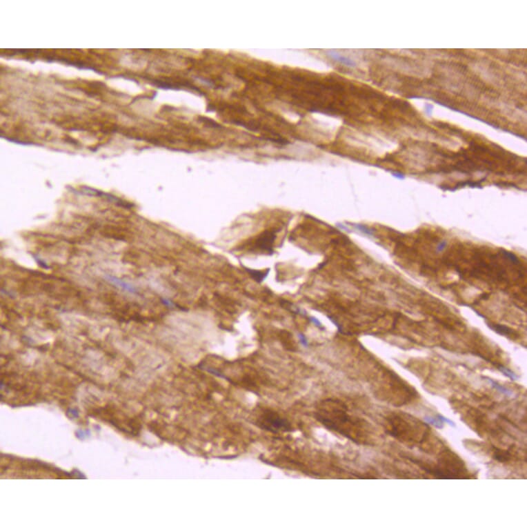 Immunohistochemistry - Anti-DES Antibody (A10837) - Antibodies.com