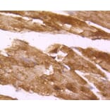 Immunohistochemistry - Anti-DES Antibody (A10837) - Antibodies.com