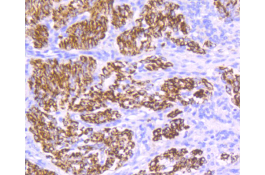 Immunohistochemistry - Anti-DES Antibody (A10837) - Antibodies.com