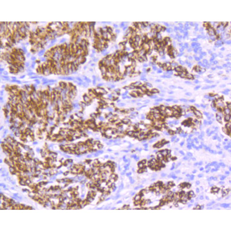 Immunohistochemistry - Anti-DES Antibody (A10837) - Antibodies.com