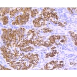 Immunohistochemistry - Anti-DES Antibody (A10837) - Antibodies.com
