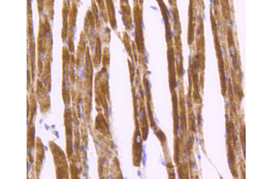 Immunohistochemistry - Anti-DES Antibody (A10837) - Antibodies.com