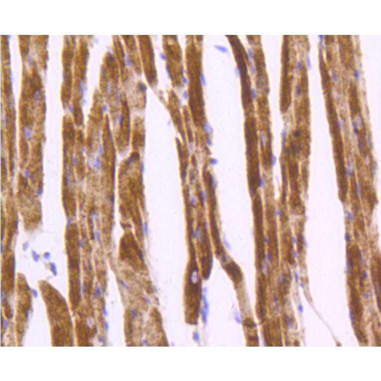 Immunohistochemistry - Anti-DES Antibody (A10837) - Antibodies.com