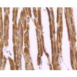 Immunohistochemistry - Anti-DES Antibody (A10837) - Antibodies.com