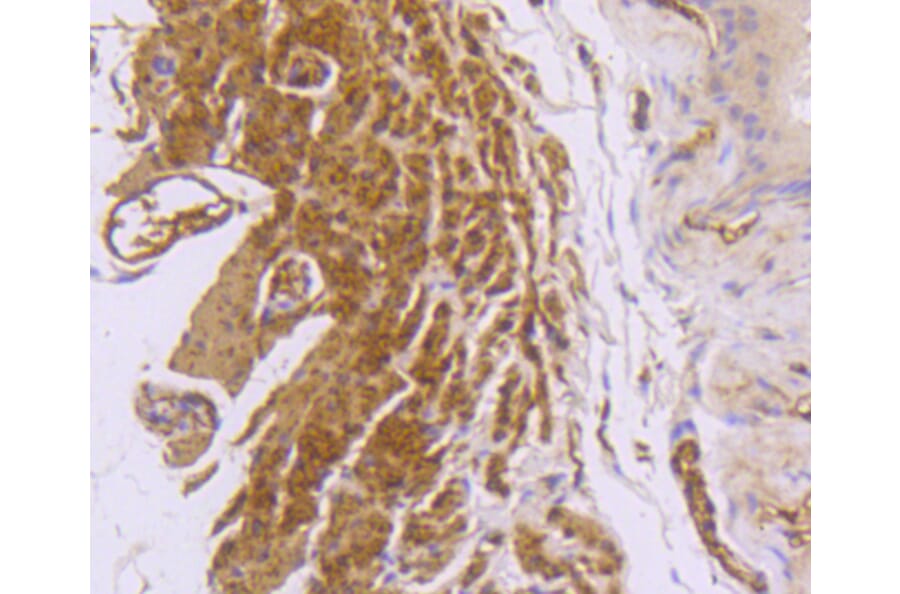 Immunohistochemistry - Anti-DES Antibody (A10837) - Antibodies.com