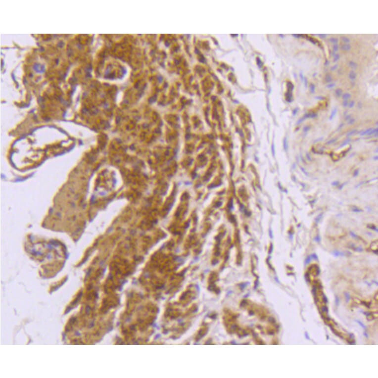 Immunohistochemistry - Anti-DES Antibody (A10837) - Antibodies.com
