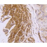 Immunohistochemistry - Anti-DES Antibody (A10837) - Antibodies.com