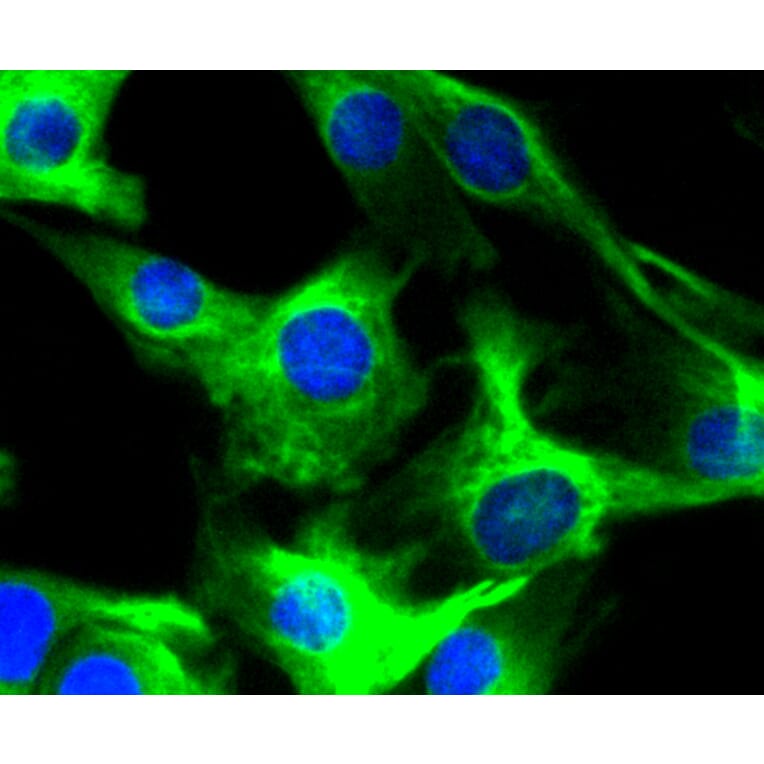 Immunofluorescence - Anti-DES Antibody (A10837) - Antibodies.com