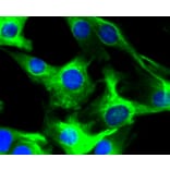 Immunofluorescence - Anti-DES Antibody (A10837) - Antibodies.com