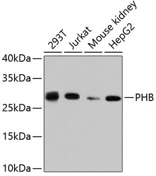 Western blot analysis of extracts of various cell lines, using Anti-PHB Antibody (A11077).
Secondary antibody: Goat Anti-Rabbit IgG (H+L) (HRP) (AS014) at 1:10,000 dilution.
Lysates / proteins: 25µg per lane.
Blocking buffer: 3% non-fat dry milk in TBST.