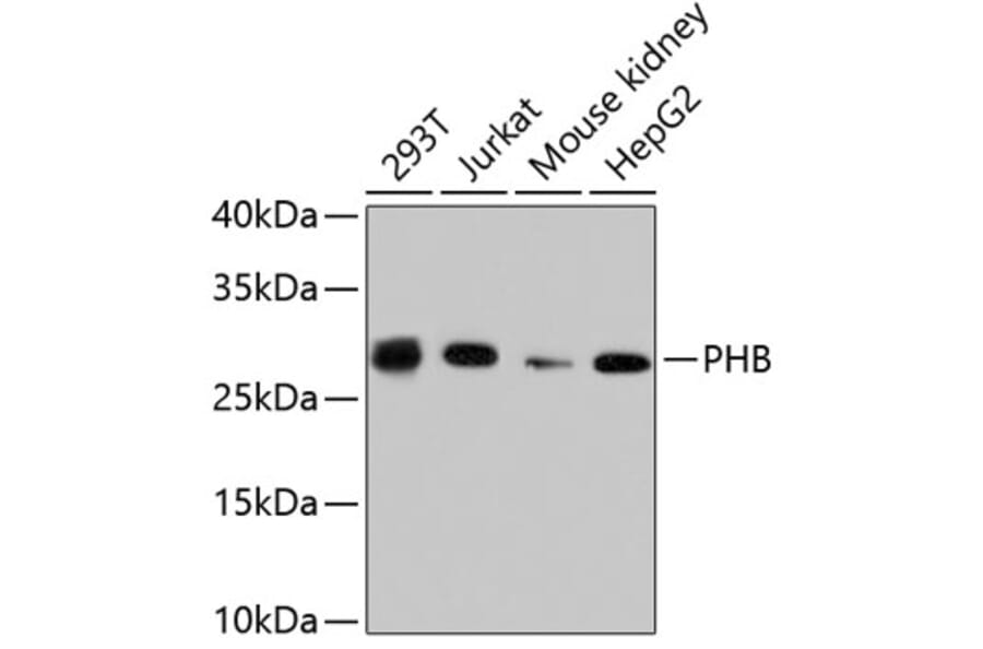 Western Blot - Anti-PHB Antibody (A11077) - Antibodies.com