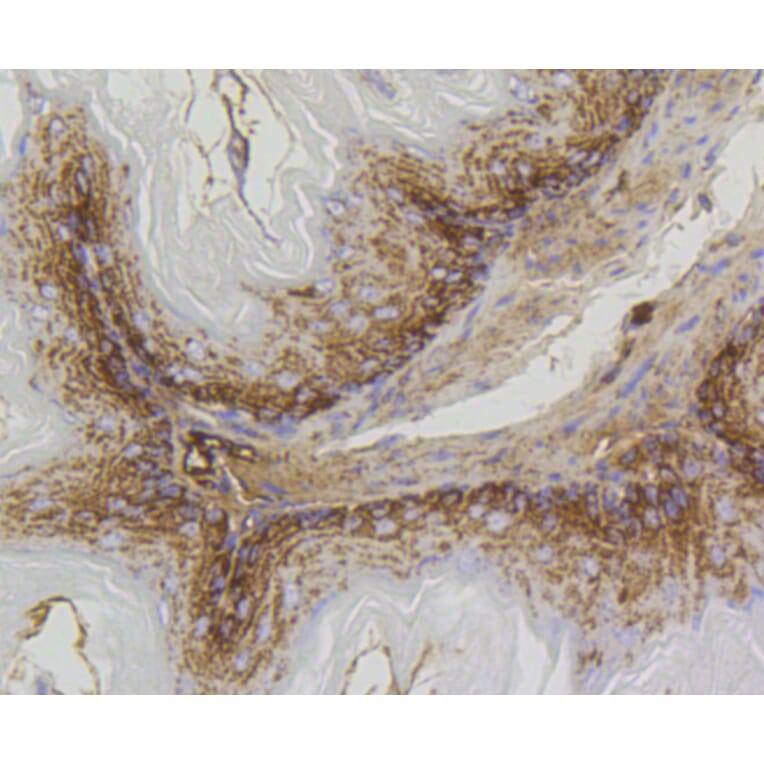 Immunohistochemistry - Anti-PHB Antibody (A11077) - Antibodies.com