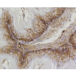 Immunohistochemistry - Anti-PHB Antibody (A11077) - Antibodies.com