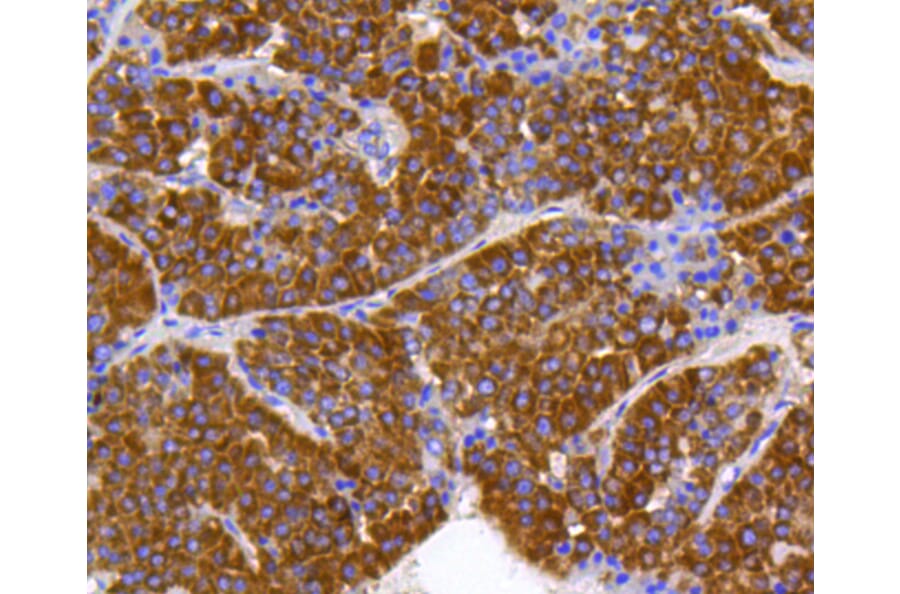 Immunohistochemistry - Anti-PHB Antibody (A11077) - Antibodies.com